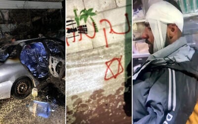 Left to right: A vehicle allegedly torched by settlers near Hebron, overnight May 16-17, 2026; graffiti reading 'Revenge' from the same location; a Palestinian man wrapped in bandages after an alleged settler attack near Bethlehem, May 17, 2026. (All photos from social media, used in accordance with Clause 27a of the Copyright Law)