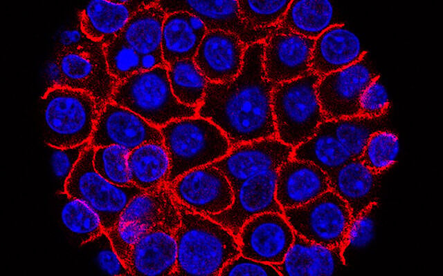 This undated microscope image from USC via the NIH shows pancreatic cancer cells, nuclei in blue, growing as a sphere encased in membranes, red. (Min Yu/Eli and Edythe Broad Center for Regenerative Medicine and Stem Cell Research at USC, USC Norris Comprehensive Cancer Center, File)