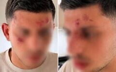 Shalev Ben Yakar after being assaulted in Golders Green, May 18, 2026. (Screenshot/ X/ Ynet)