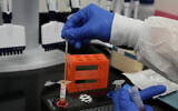 Illustrative: A laboratory technician at bioMérieux's Salt Lake City, Utah, manufacturing facility on June 11, 2026, prepares a sample of a diagnostic test that detects the Ebola Bundibugyo strain responsible for recent outbreaks in Central and East Africa. (Niki Chan Wylie/AP Content Services for bioMérieux)