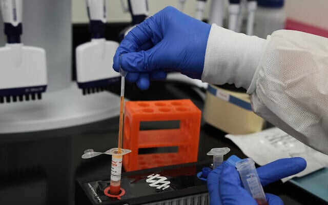 Illustrative: A laboratory technician at bioMérieux's Salt Lake City, Utah, manufacturing facility on June 11, 2026, prepares a sample of a diagnostic test that detects the Ebola Bundibugyo strain responsible for recent outbreaks in Central and East Africa. (Niki Chan Wylie/AP Content Services for bioMérieux) Illustrative: A laboratory technician at bioMérieux's Salt Lake City, Utah, manufacturing facility on June 11, 2026, prepares a sample of a diagnostic test that detects the Ebola Bundibugyo strain responsible for recent outbreaks in Central and East Africa. (Niki Chan Wylie/AP Content Services for bioMérieux)