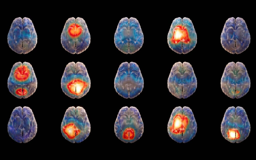 Israeli startup looks to harness AI to decode the ‘language’ of the brain