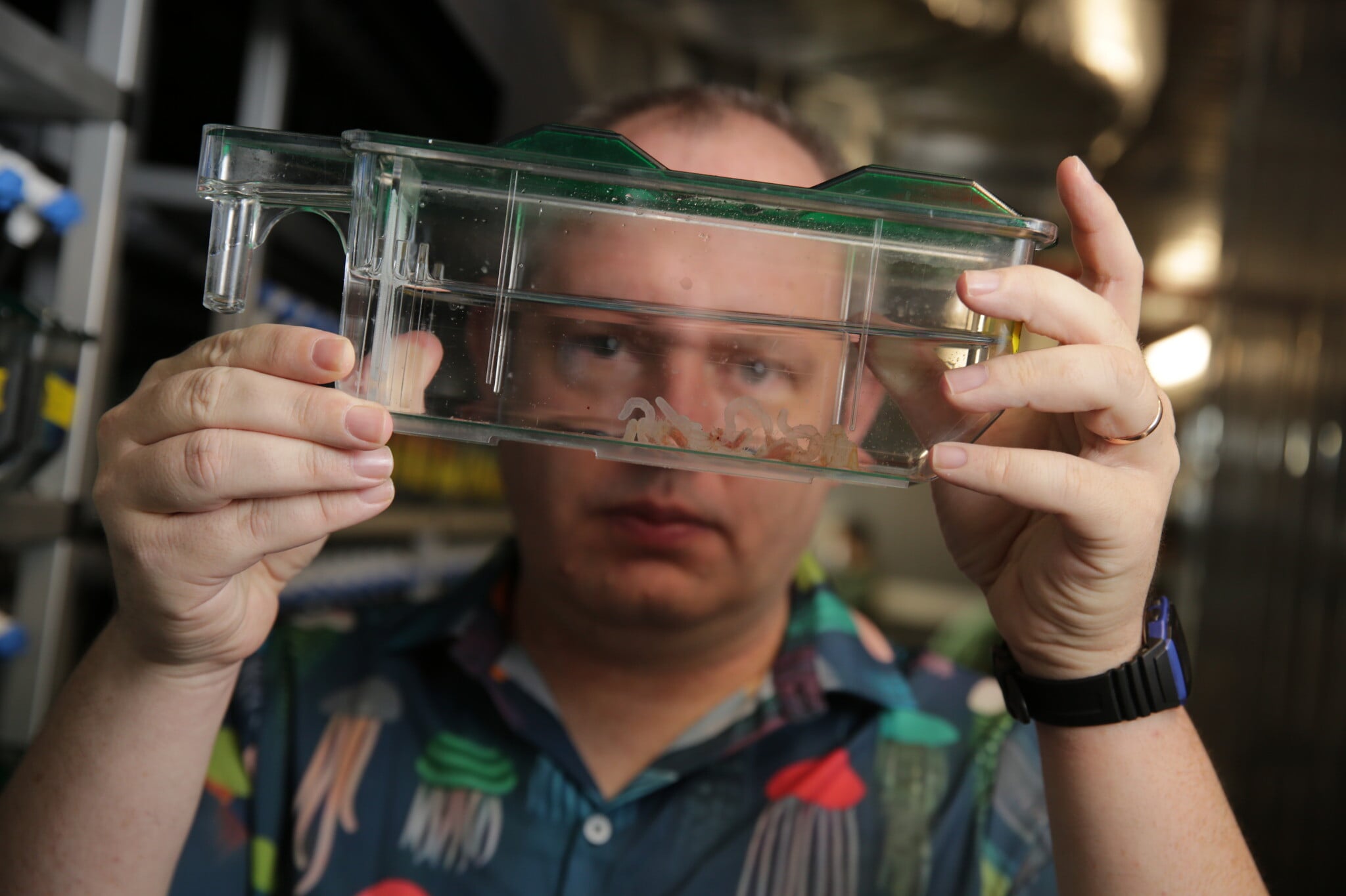 Israeli scientists say they’ve discovered a unique immune system in sea anemones