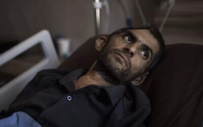 Mujahed Bani Mufleh lies in a hospital bed where he is receiving treatment after being released from Israeli jail, July 8, 2026. (JOHN WESSELS/AFP)