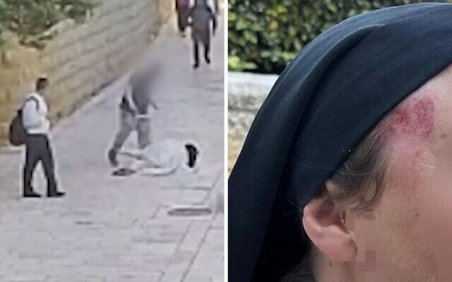 A nun seen with a bruise to the head (left) after a man allegedly attacked her near King David's Tomb in the Old City of Jerusalem on April 28, 2026. (Screenshot/Israel Police)