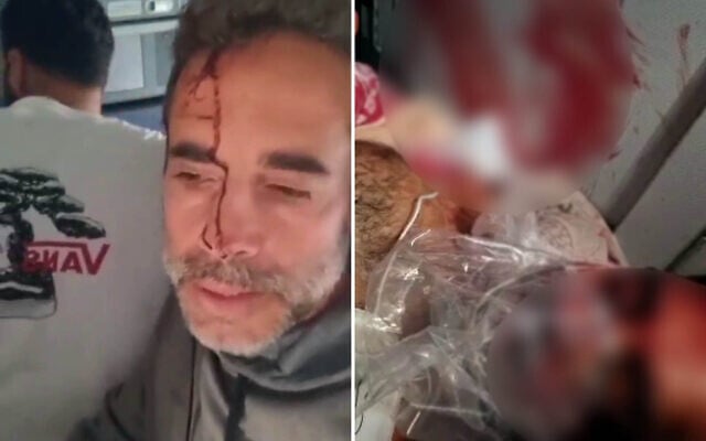 Images from aboard a flydubai flight from Dubai to Tel Aviv that suffered an emergency mid-air, with the co-pilot subdued after stabbing the captain in an alleged attempt to crash the plane full of Israelis, September 30, 2026. (Social media: used in accordance with Clause 27a of the Copyright Law)