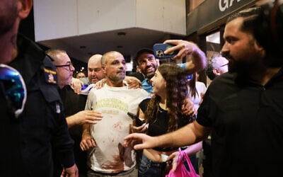 Passenger Yaniv Hayun, with blood stains on his shirt, one of the Israelis who helped subdue a flydubai copilot who allegedly sought to hijack and crash a plane full of Israelis, at Ben Gurion Airport, September 30, 2026. (AP Photo/Tomer Appelbaum)