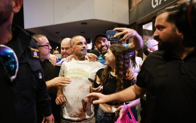 Passenger Yaniv Hayun, with blood stains on his shirt, one of the Israelis who helped subdue a flydubai copilot who allegedly sought to hijack and crash a plane full of Israelis, at Ben Gurion Airport, September 30, 2026. (AP Photo/Tomer Appelbaum)