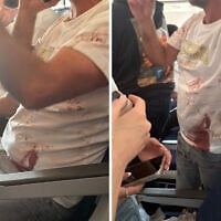 A passenger is seen with a bloodied shirt aboard a flydubai flight from Dubai to Tel Aviv that suffered an emergency mid-air, with the co-pilot subdued after stabbing the captain in an alleged attempt to crash the plane full of Israelis, September 30, 2026 (Social media: used in accordance with Clause 27a of the Copyright Law)