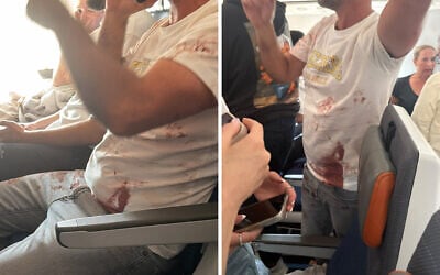 A passenger is seen with a bloodied shirt aboard a flydubai flight from Dubai to Tel Aviv that suffered an emergency mid-air, with the co-pilot subdued after stabbing the captain in an alleged attempt to crash the plane full of Israelis, September 30, 2026 (Social media: used in accordance with Clause 27a of the Copyright Law) A passenger is seen with a bloodied shirt aboard a flydubai flight from Dubai to Tel Aviv that suffered an emergency mid-air, with the co-pilot subdued after stabbing the captain in an alleged attempt to crash the plane full of Israelis, September 30, 2026 (Social media: used in accordance with Clause 27a of the Copyright Law)