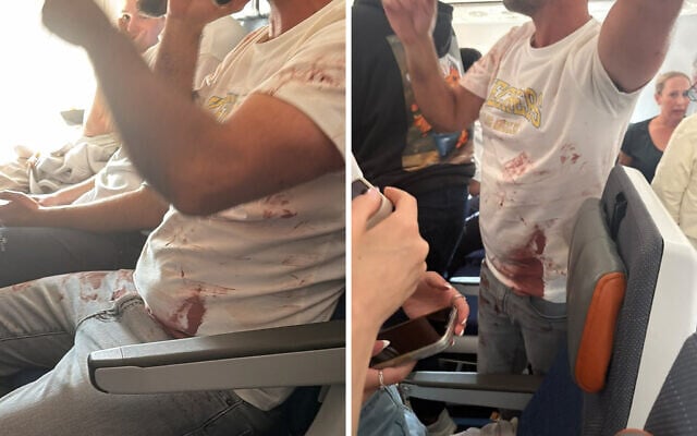 A passenger is seen with a bloodied shirt aboard a flydubai flight from Dubai to Tel Aviv that suffered an emergency mid-air, amid reports of a fight in the cockpit, September 30, 2026 (Courtesy)