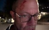 A photo Dan Levene posted after reporting that he was assaulted by anti-Israel graffiti artists, October 7, 2026. (Dan Levene/X)