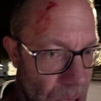 A photo Dan Levene posted after reporting that he was assaulted by anti-Israel graffiti artists, October 7, 2026. (Dan Levene/X)