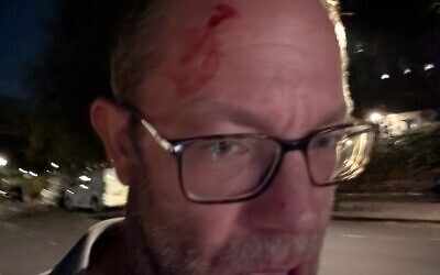 A photo Dan Levene posted after reporting that he was assaulted by anti-Israel graffiti artists, October 7, 2026. (Dan Levene/X)